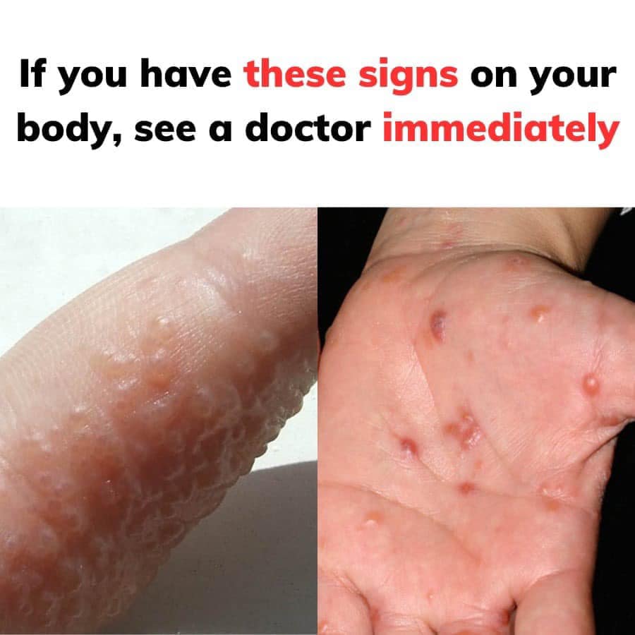 See a Doctor Right Away if You Notice These Signs on Your Body