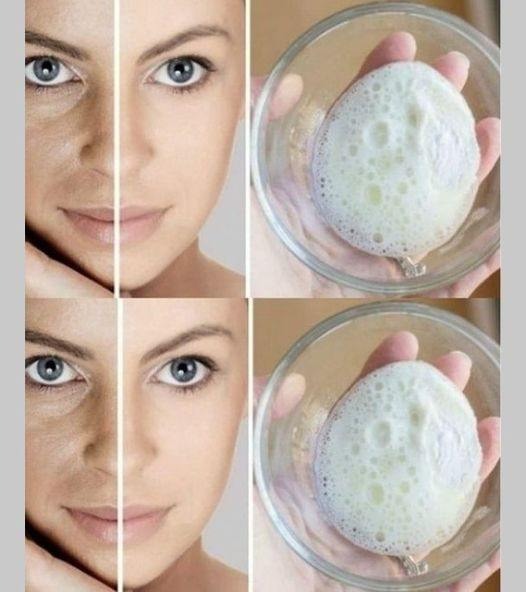 How to create a baking soda cream that helps reduce wrinkles, skin spots, and blackheads.