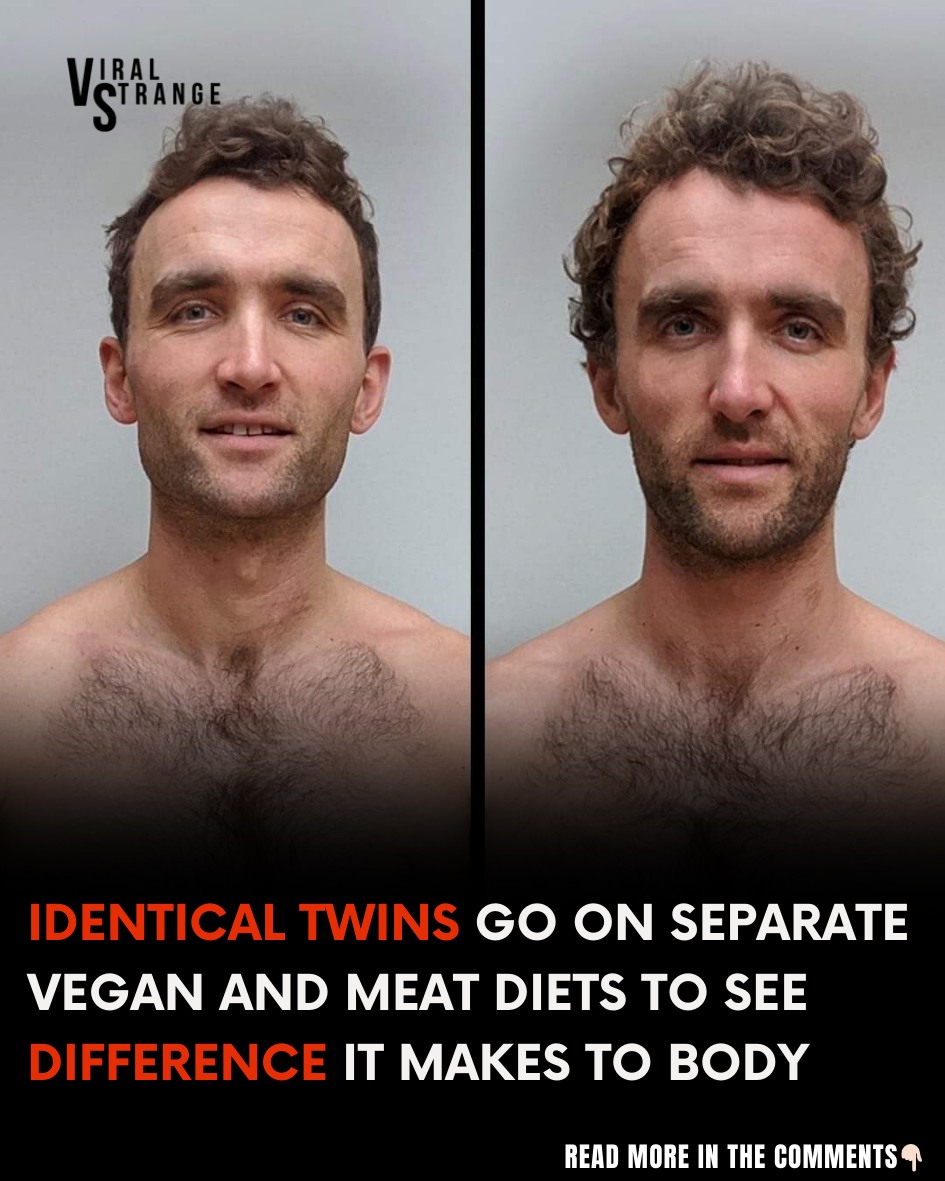 Identical Twins Compare Vegan and Omnivorous Diets