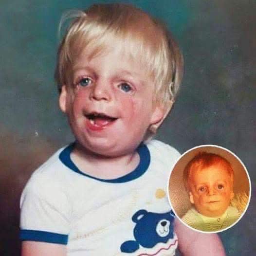 When Jono’s mother first saw his face, she ran away and left him in the maternity crib. But what this ”monster” looks like today, 30 years later, is truly amazing