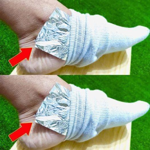 Put Aluminum Foil on Your Feet and Say Goodbye to Aches and Pains: The Surprising Hack