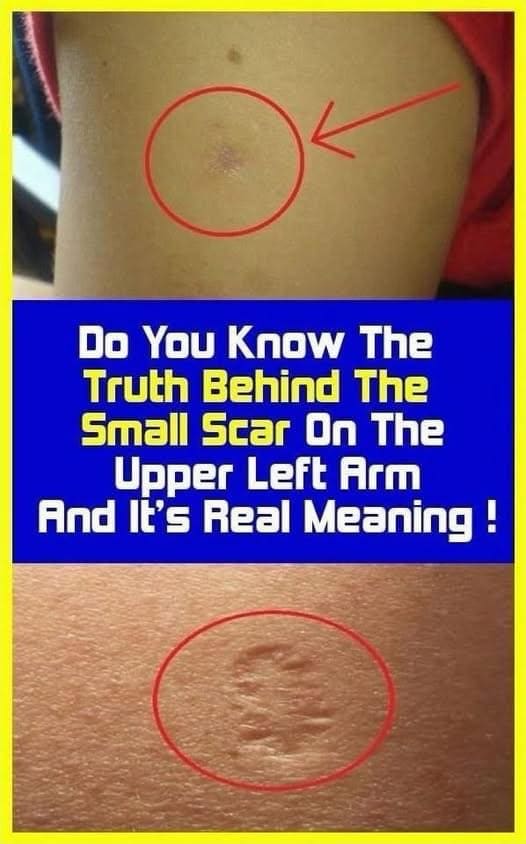 The Truth About the Scar