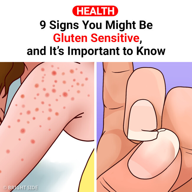 9 Signs You’re Gluten Sensitive, and This Is Important to Know