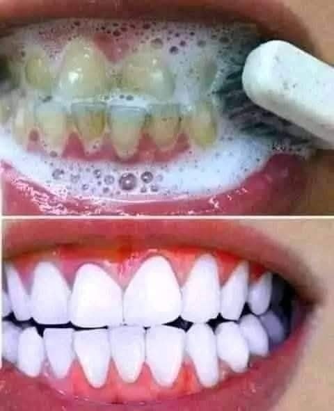 WHITEN YOUR TEETH WITH EGGSHELL