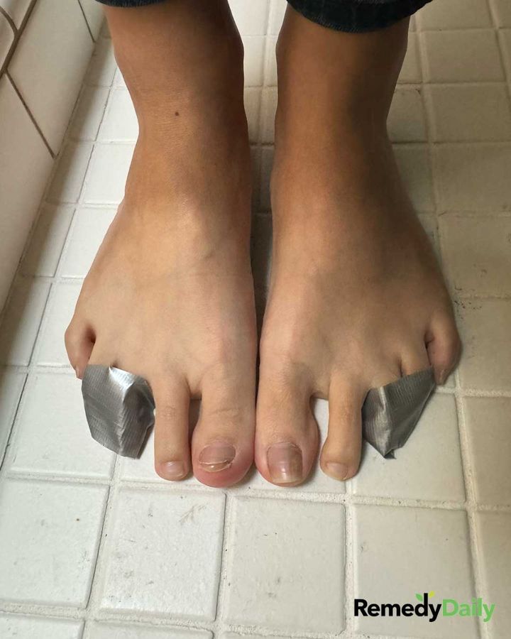 Lady tapes her 3rd and 4th toes together for this brilliant reason