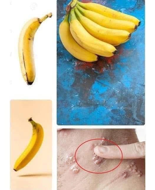 Did you know that it you eat BANANA EVERY DAY your body can… See more in first comment 👇