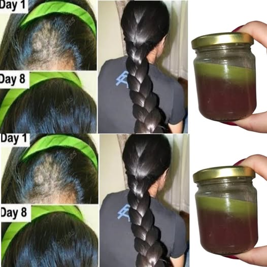 The Indian Secret to Rapid Hair Growth and Combating Baldness