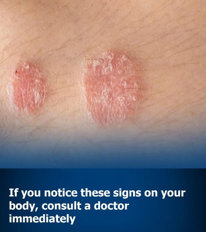 If you notice these signs on your body, consult a doctor immediately! Check comments👇🏼