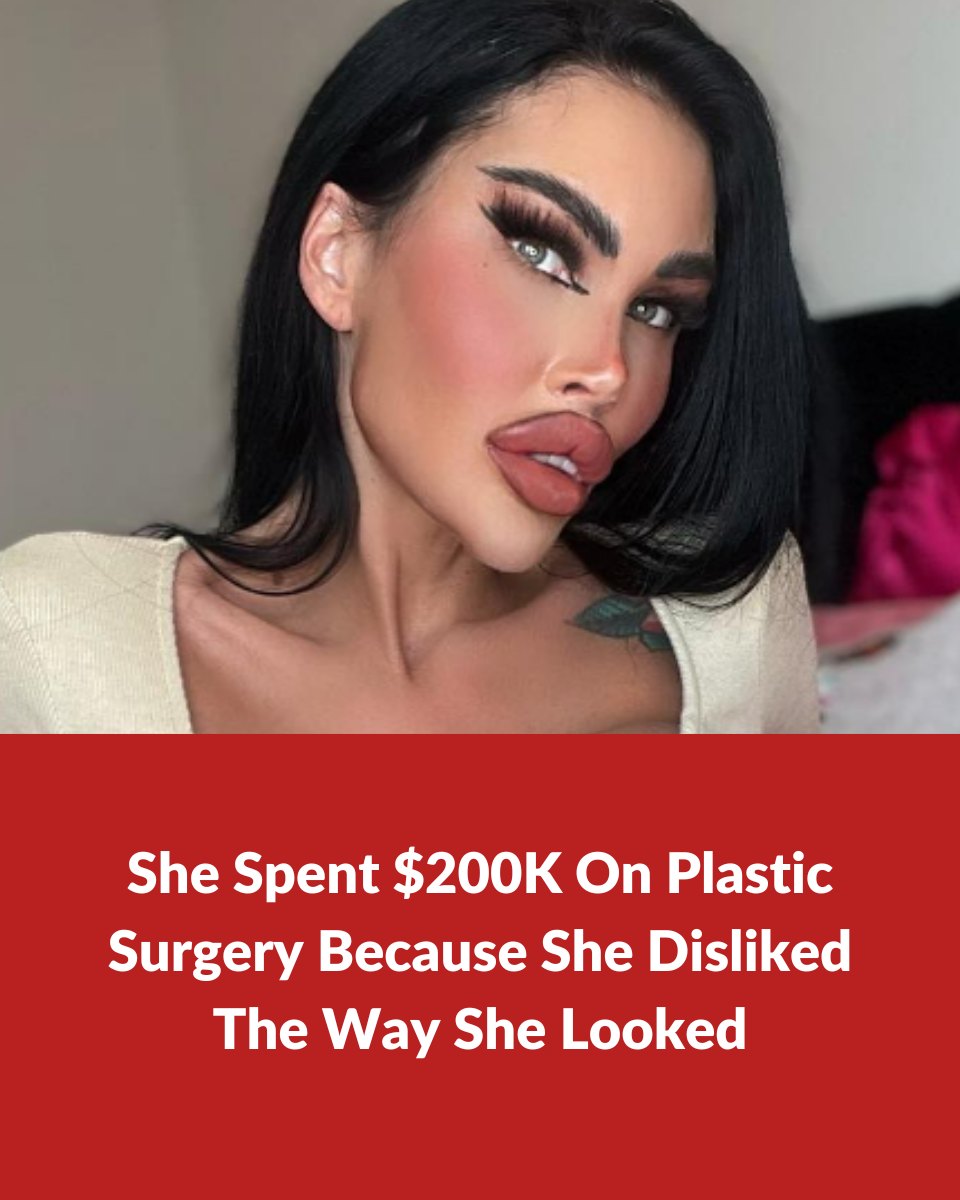 She Spent $200K On Plastic Surgery Because She Disliked The Way She Looked 😔😮😮 Pics in comments 👇