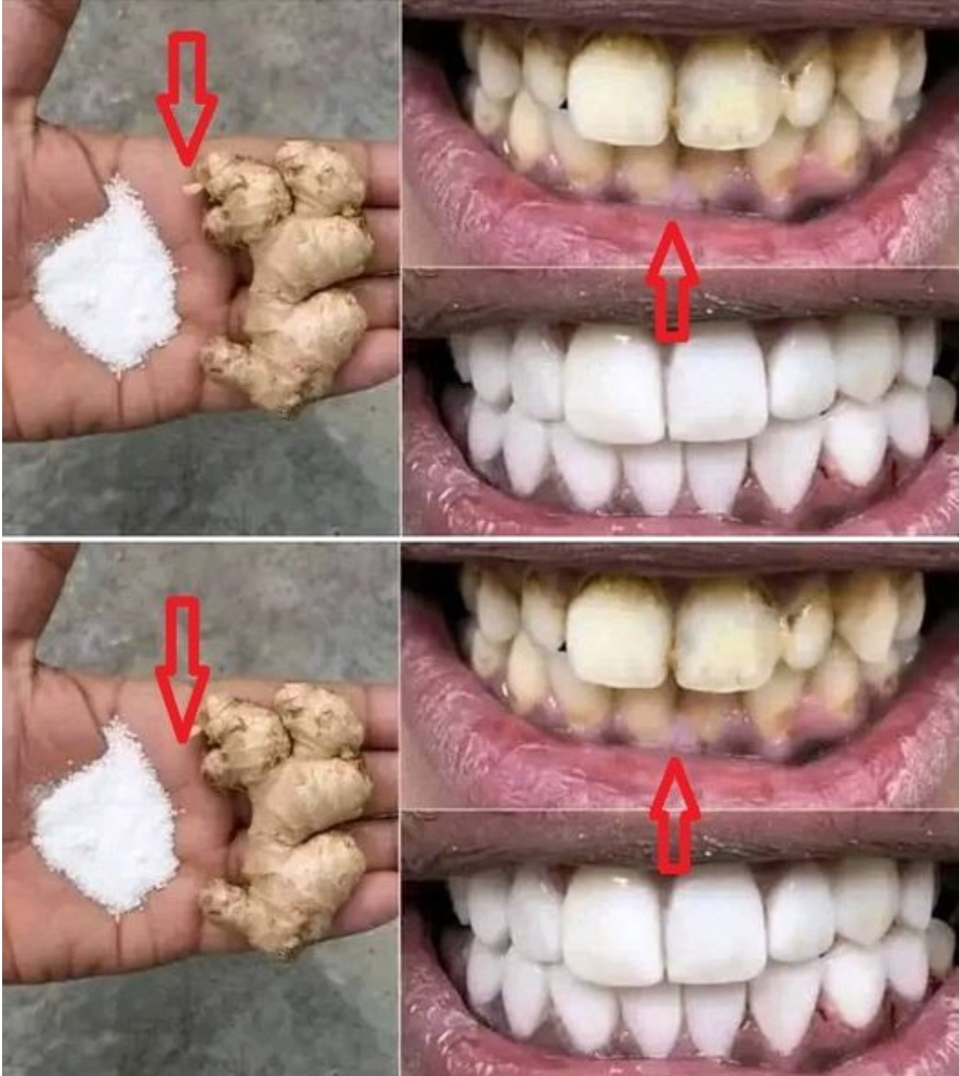 Transform Your Smile: The Ultimate Teeth Whitening Method Unveiled! Check comments⬇️