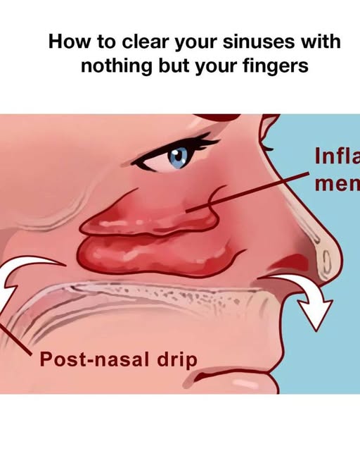 How to clear your sinuses with nothing but your fingers