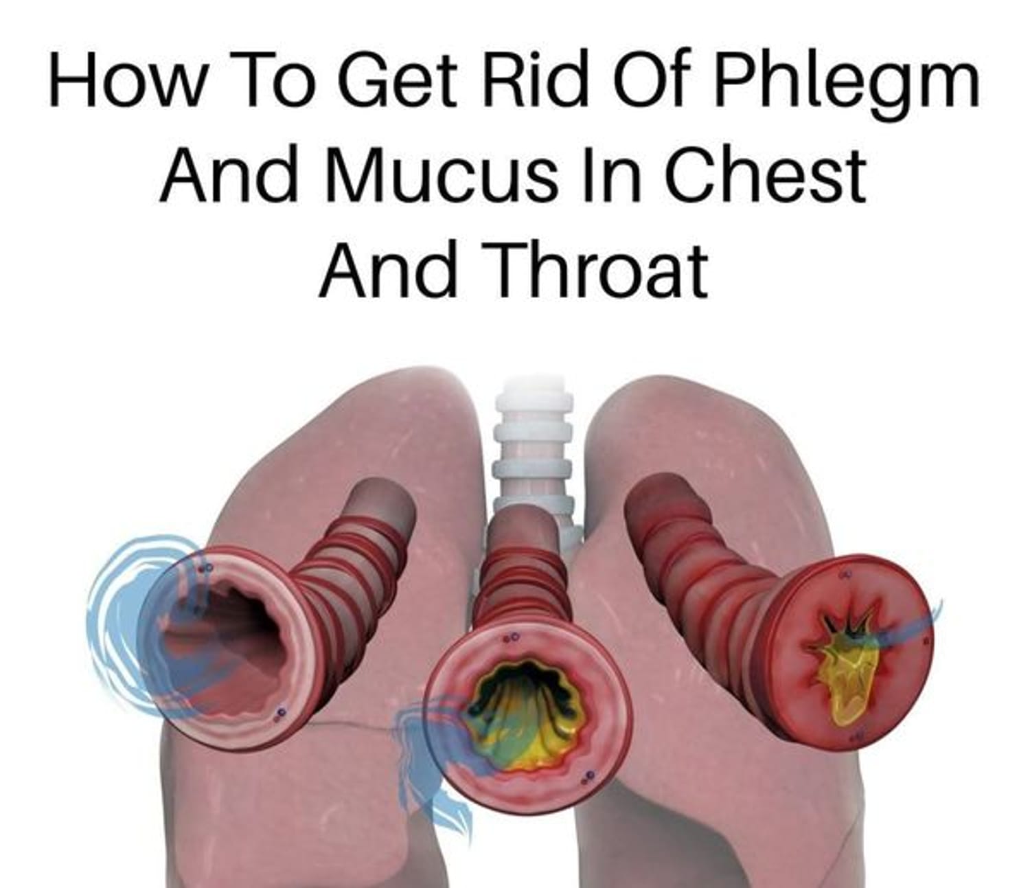 7 Ways To Get Rid Of Phlegm And Mucus In Chest And Throat 👇👇