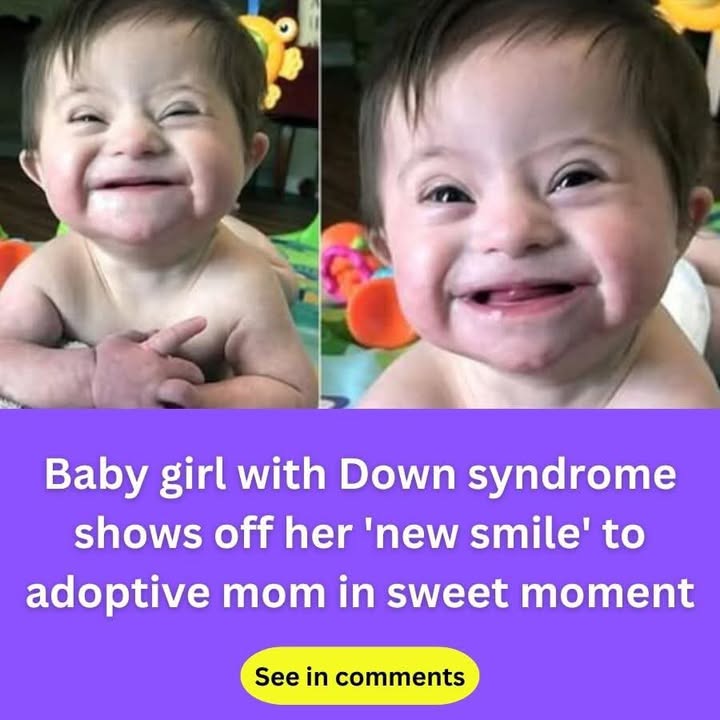 Adopted baby with Down syndrome melts hearts after smiling for mom