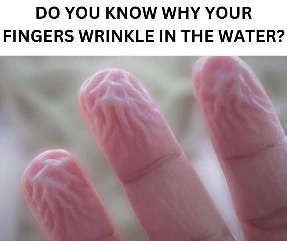 Why do your fingers wrinkle with water