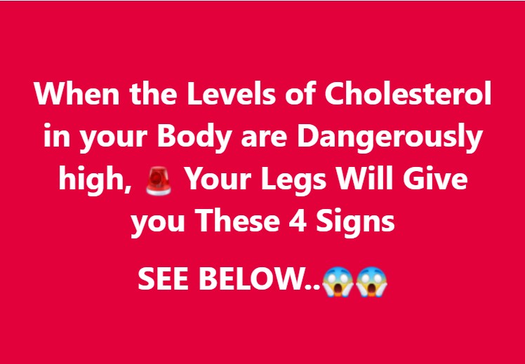 When the Levels of Cholesterol in your Body are Dangerously high, 🚨 Your Legs Will Give you These 4 Signs