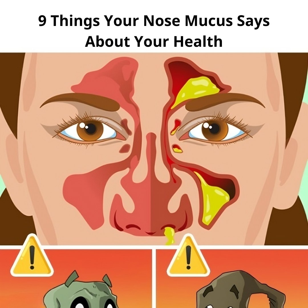 We’ve rounded up 9 types of mucus and what they mean. Read on to understand what your body is telling you! 🩺 (Link in comments 👇)