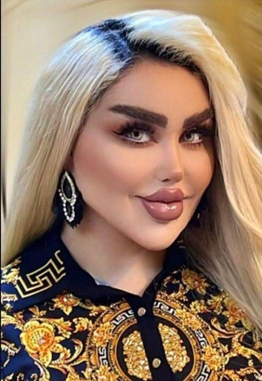 She had 43 cosmetic procedures to become a “REAL” Barbie Doll. But just wait until you see how she looked before the surgeries photo in comments