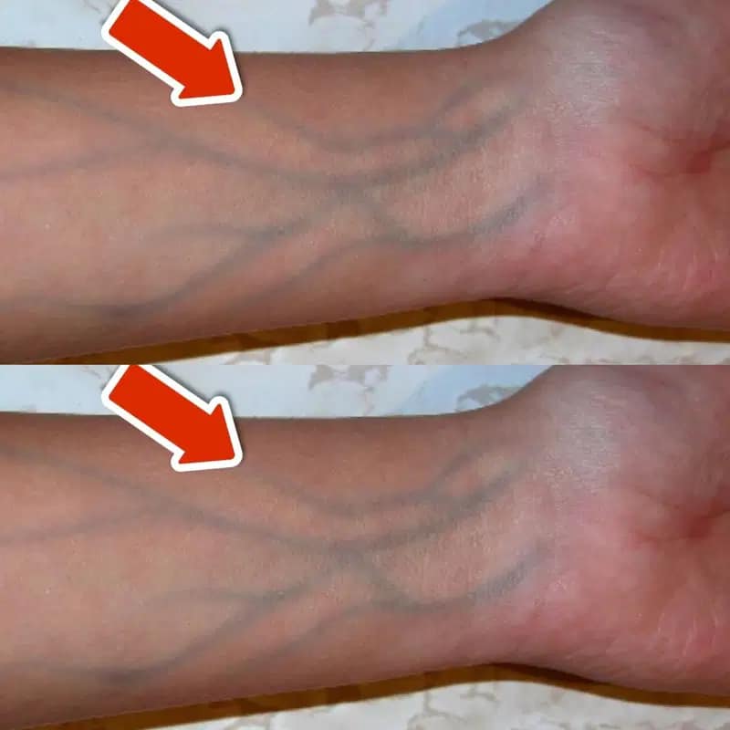 5 signs of poor circulation that you should NEVER ignore💥(IMPORTANT)🤯 Recipe in comment 👇