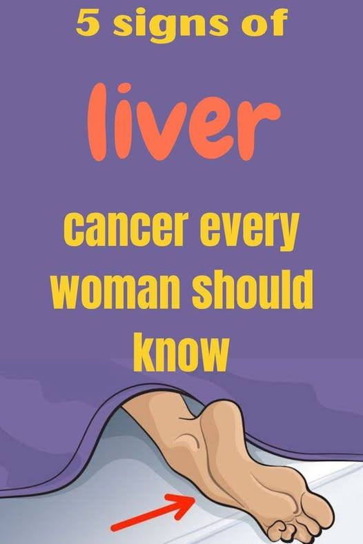 5 signs of liver cancer every woman should know Full article 👇 💬