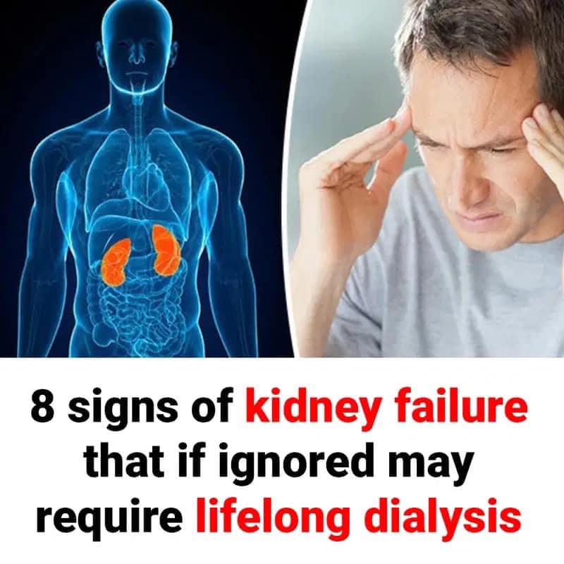 8 signs of kidney failure that if ignored may require lifelong dialysis..Read full story in comments…👇