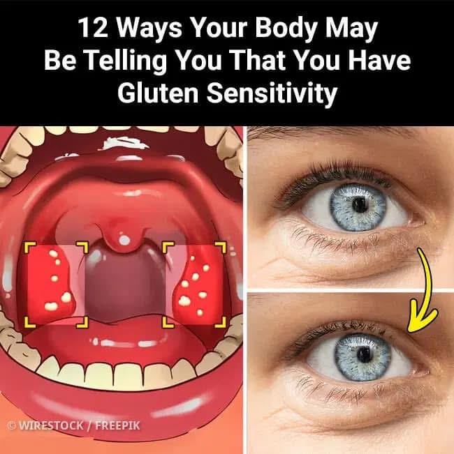 Gluten might appear harmless, but for some individuals, it can silently provoke significant health problems.👇🏼