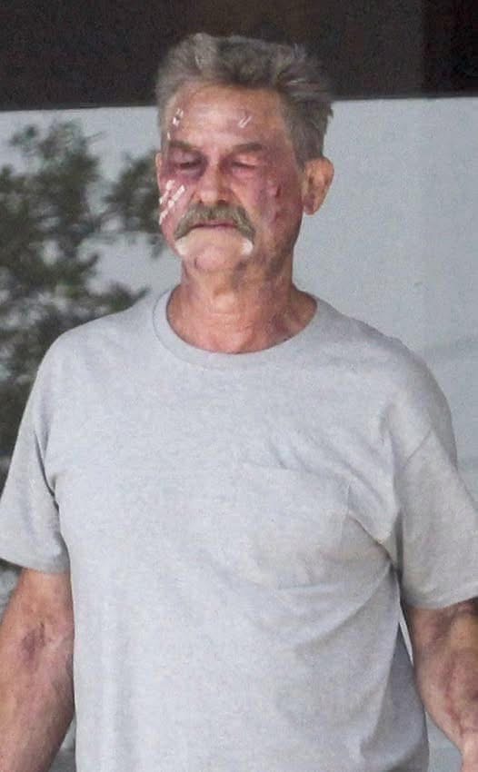 Oh No!!! Kurt Russell 💔 What he’s going through right now is beyond heartbreaking. Full story in the comments 👇