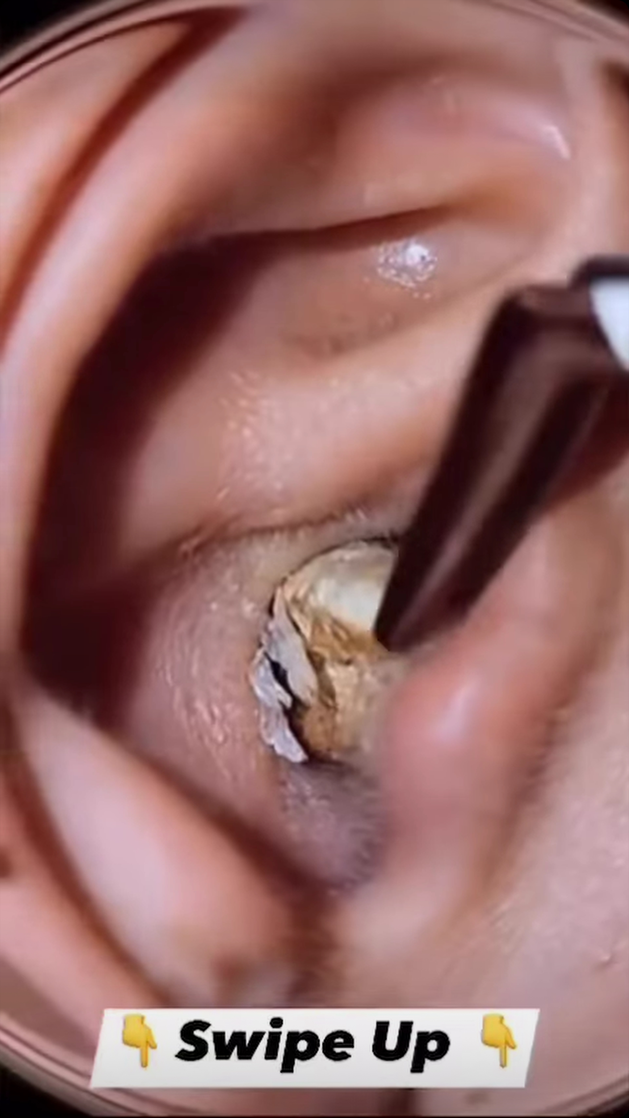 Symptoms of Ear Infection You Shouldn’t Ignore and Common Causes